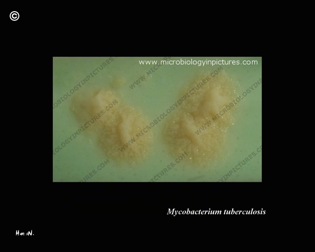 mycobacterium tuberculosis colony close-up